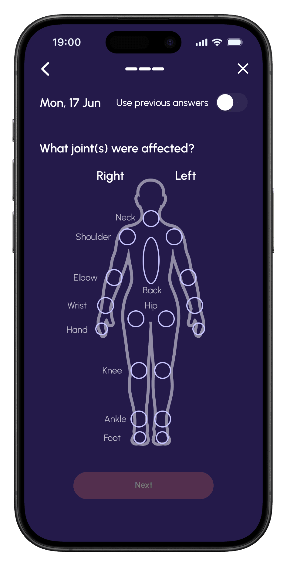Joint map: which joints were affected