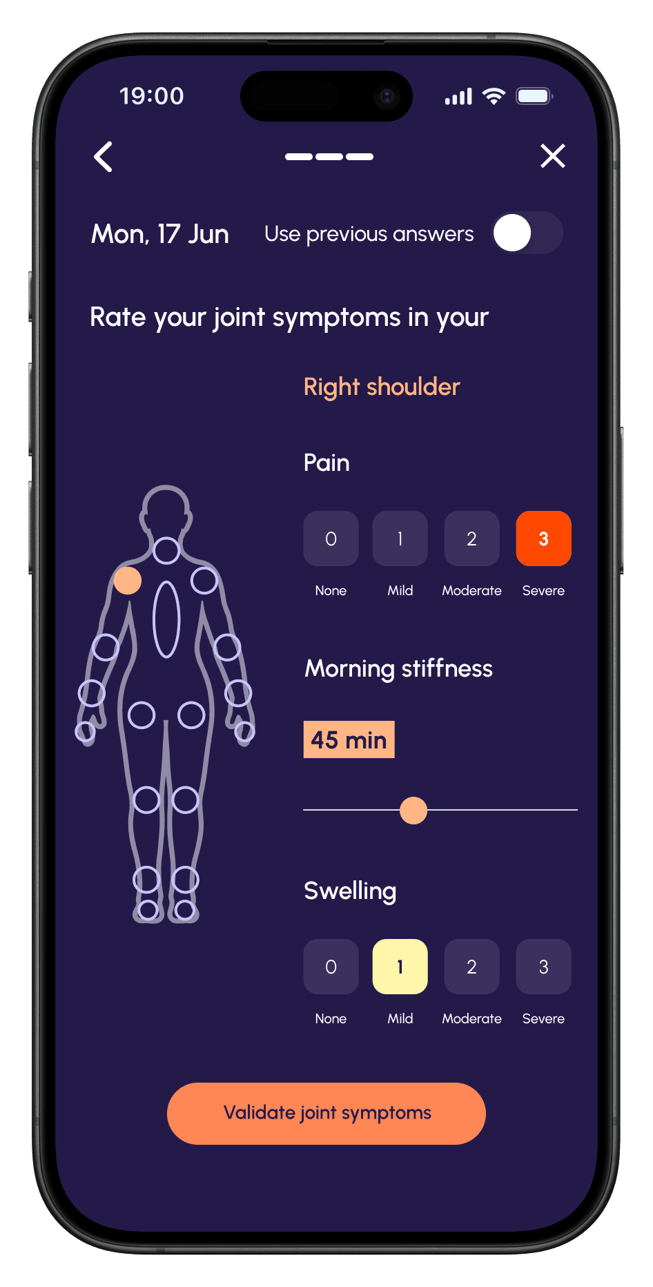 Rating pain, morning stiffness and swelling for the right shoulder